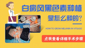 廊坊哪家医院做白癜风手术做的好