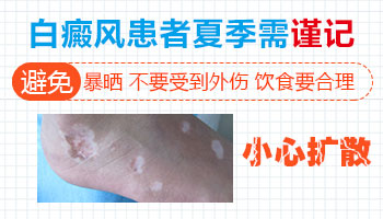 夏季治疗白癜风效果好的方法