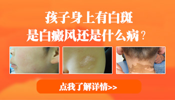 四岁孩子身上有白色斑点的原因有哪些
