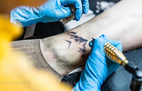 白癜风稳定期可以纹身遮盖吗