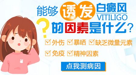 为什么‌女性会患白癜风