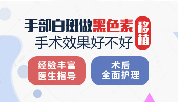 手上白癜风光疗不起作用