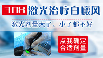 白癜风照光正常的话应该有什么反应