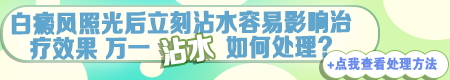 311照射白癜风好转现象