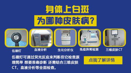 皮肤上长白点点就是得了白癜风吗