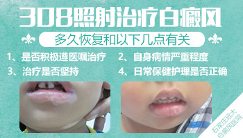 光疗多久白癜风会出现色素岛