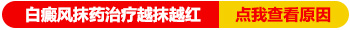 白癜风能用药物治疗吗 盲目用药治白危害大