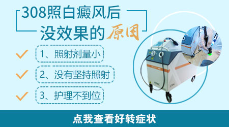 为什么白癜风照射308准分子没效果