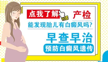 父亲白癜风胎儿可以做筛查吗