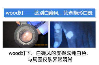 眼睛皮上长了白斑图片