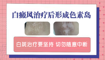白斑中间出现色素岛是在好转吗
