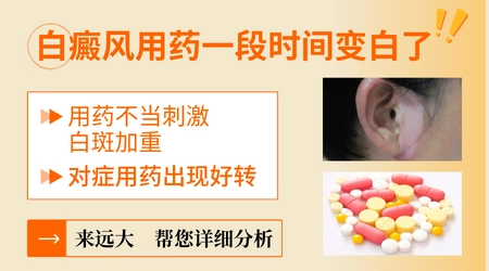 白癜风用药后白颜色变淡