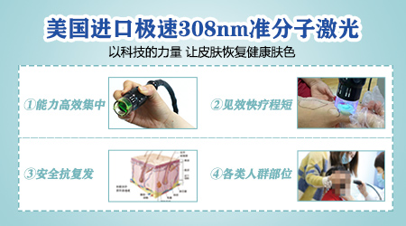 小块状的白癜风买什么型号的治疗仪