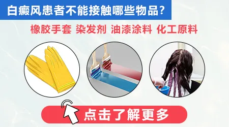长期接触化学物质会得白癜风吗