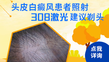 治疗额头和后脑勺发展期白癜风需要剃头吗