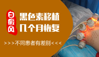 白癜风治疗后好转实例图