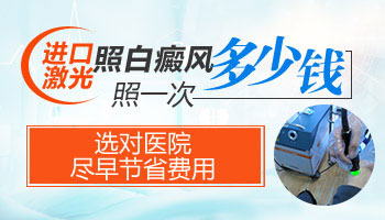 早期白癜风照一次308激光大概多少钱