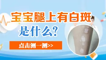 三个月宝宝腿上长白点是不是白癜风
