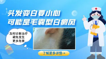 白斑部位毛发变白一定是白癜风吗