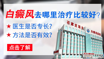 邯郸哪里治白癜风治得好