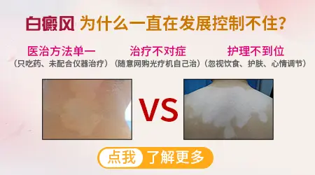 白斑会随着时间发展吗？它会变大吗？
