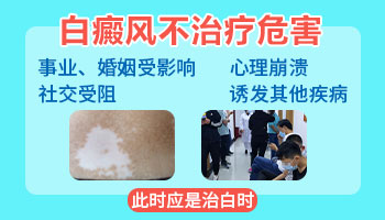 照伍德灯说有淡白色荧光是不是白癜风