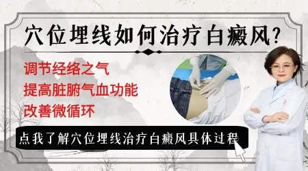 白癜风穴位埋线埋哪几个穴位