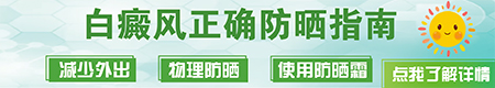 夏季白癜风复发和晒太阳有关系吗