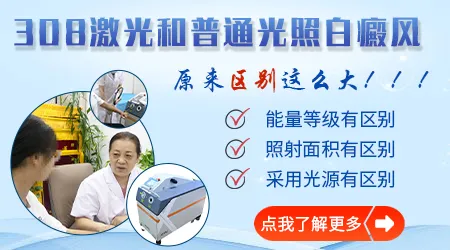 白癜风照308激光国产和美国进口效果区别大不大