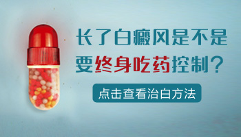 白癜风做了表皮移植还需要吃多久的药