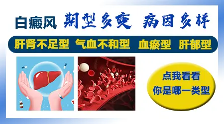 皮肤CT能检查出白斑的病因吗