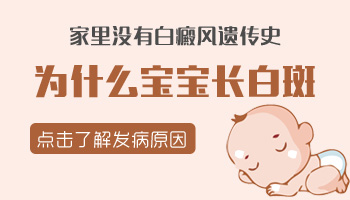家里没有白癜风史孩子会不会得白癜风