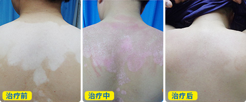 脖子后面和背上有一点点白斑