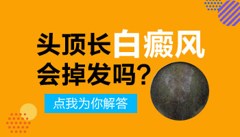 2周宝宝头上长白点是白癜风吗
