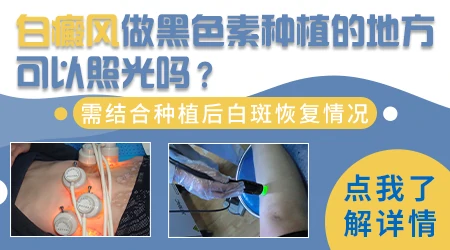 白癜风做色素移植能报销吗
