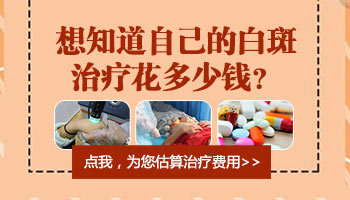 晕痣型白癜风治好多少钱
