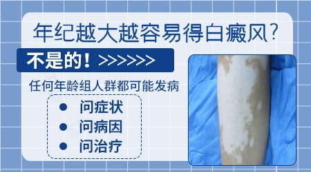胳膊白斑是不是白癜风 符合这几个白癜风症状就是