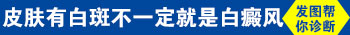 儿童脸上有淡白块是什么 白块怎么治疗好
