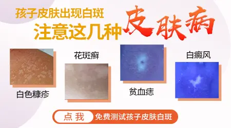 女童鼻子上长白斑是怎么回事