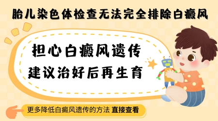 如何在孕期中检查孩小孩是否有遗传白癜风