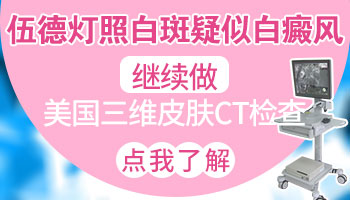 伍德灯照额头白斑结果是+是什么意思