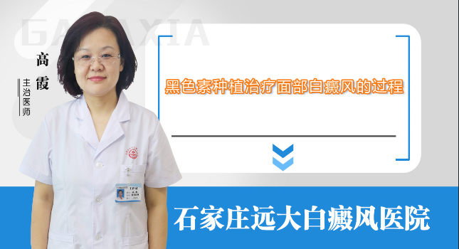 用黑色素种植法治疗面部白癜风的过程