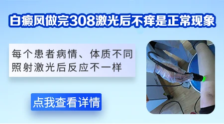 毛囊白癜风可以用308激光吗
