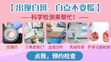 不同白斑分别有什么特殊症状对比图片