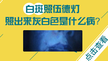 身上出现白斑 各种白斑对比