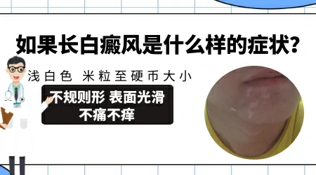 小孩手背上冒出一块白摸着光滑也不疼不痒是什么