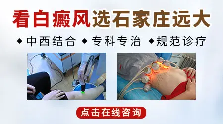 石家庄哪个医院有专门看白癜风的皮肤科