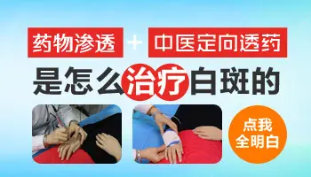 纳晶导入治疗白癜风有什么作用