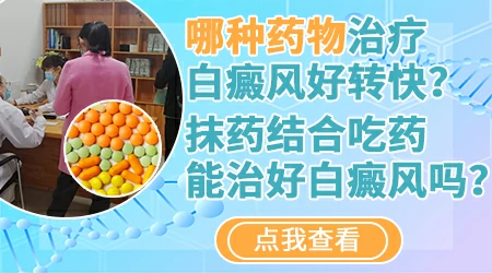 白癜风常用口服药物有哪些