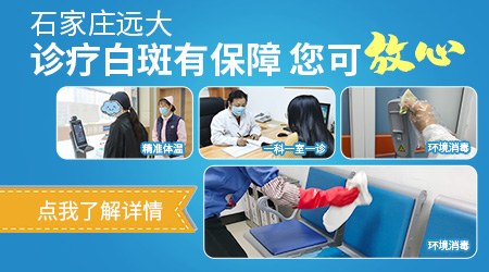 白斑照灯发蓝是白癜风吗